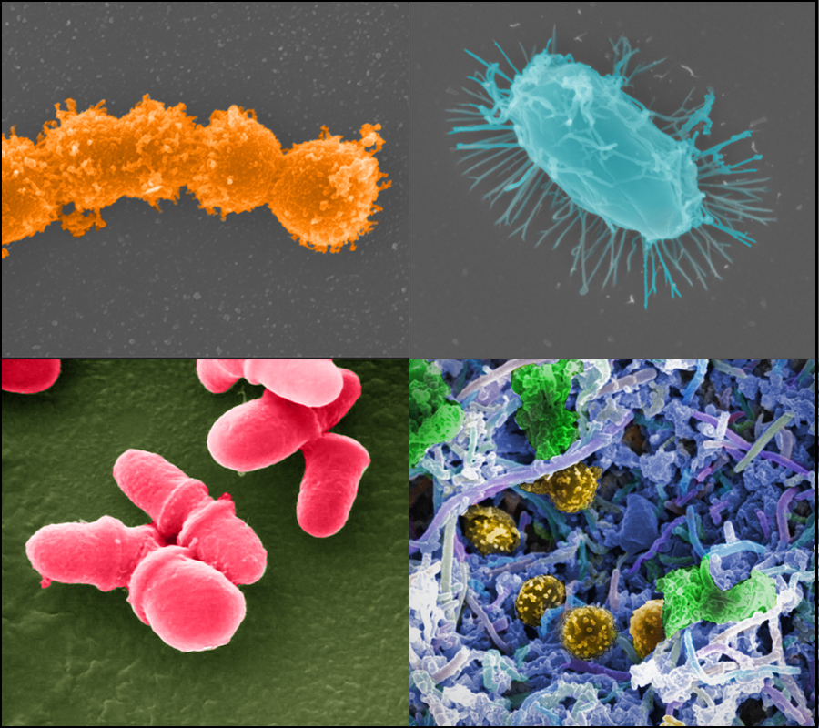 Images from the gut microbiome project including various bacteria